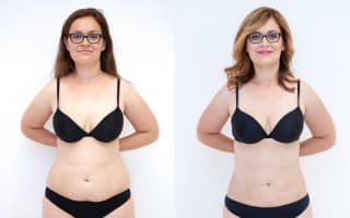 Lipotransfer