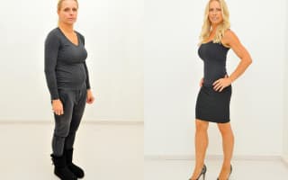 Lipotransfer