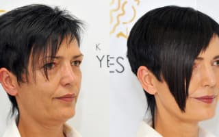 Brow and eyebrows