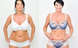 Lipotransfer