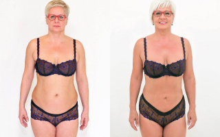 Lipotransfer