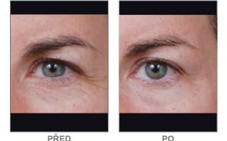 Brow and eyebrows