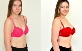 Breast enlargement