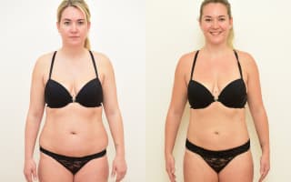 Lipotransfer