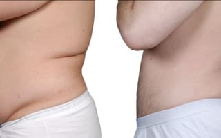 Lipotransfer