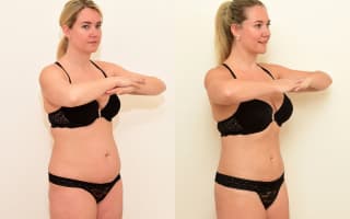 Lipotransfer