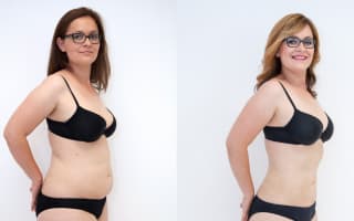 Lipotransfer