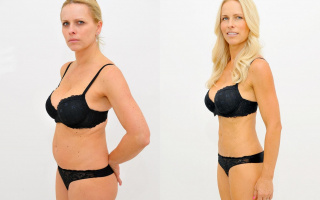 Lipotransfer