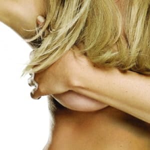 Breast plastic surgery