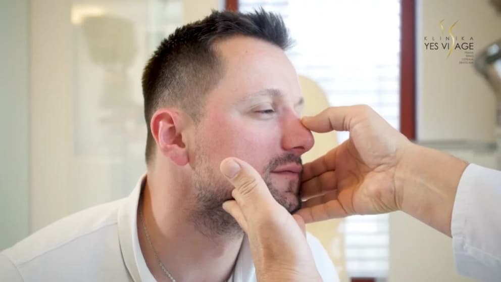 Nose surgery - Jakub